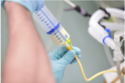 Tube feeding