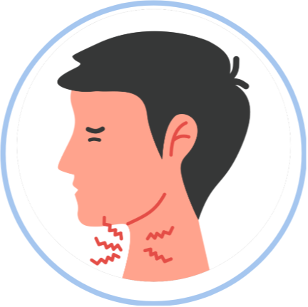 Sore throat