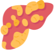 Chronic liver disease